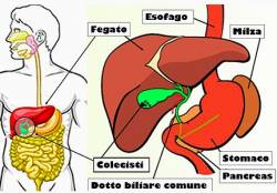 CALCOLOSI DELLA COLECISTI