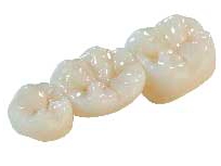 CORONA IN ZIRCONIO